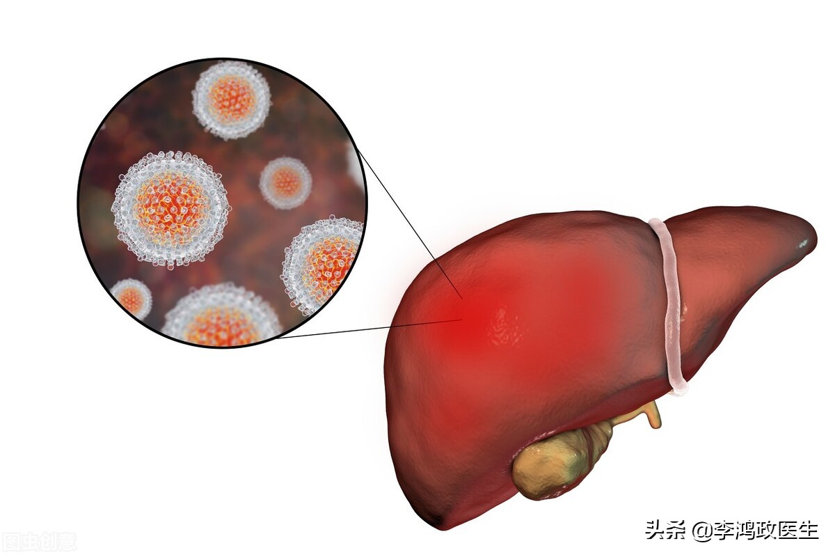 亲人进icu要十万块手术费,医生病重时为啥不愿进icu