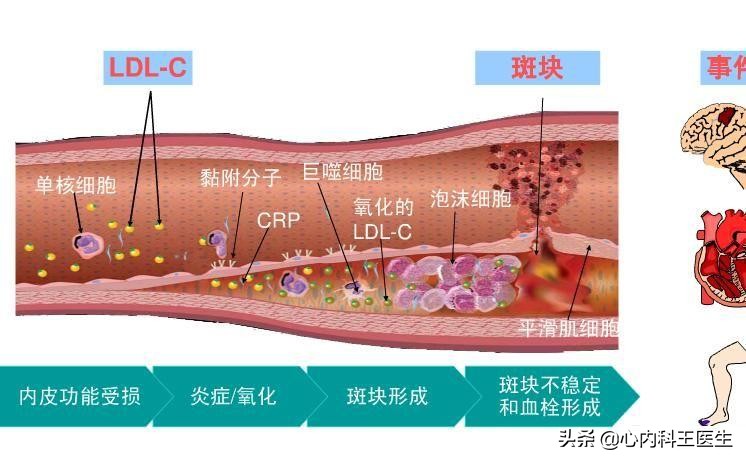 早期冠心病吃复方丹参滴丸可以吗,复方丹参滴丸治疗冠心病