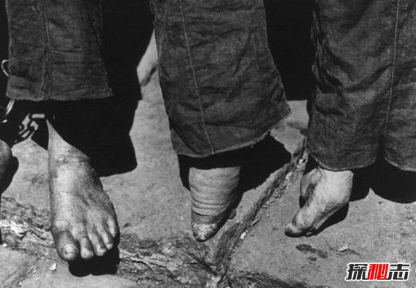 真实的三寸金莲真的好看吗,三寸金莲真的美吗