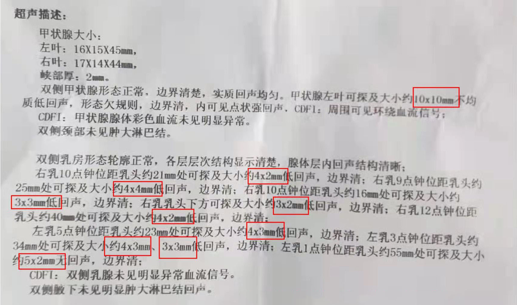 甲状腺结节有什么不同样的症状,甲状腺结节合并淋巴结异常分几类