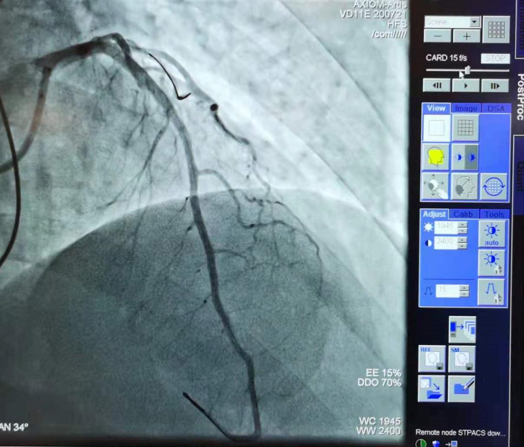 年纪轻轻的心脏不好怎么办,年纪轻轻心脏经常不舒服当心了