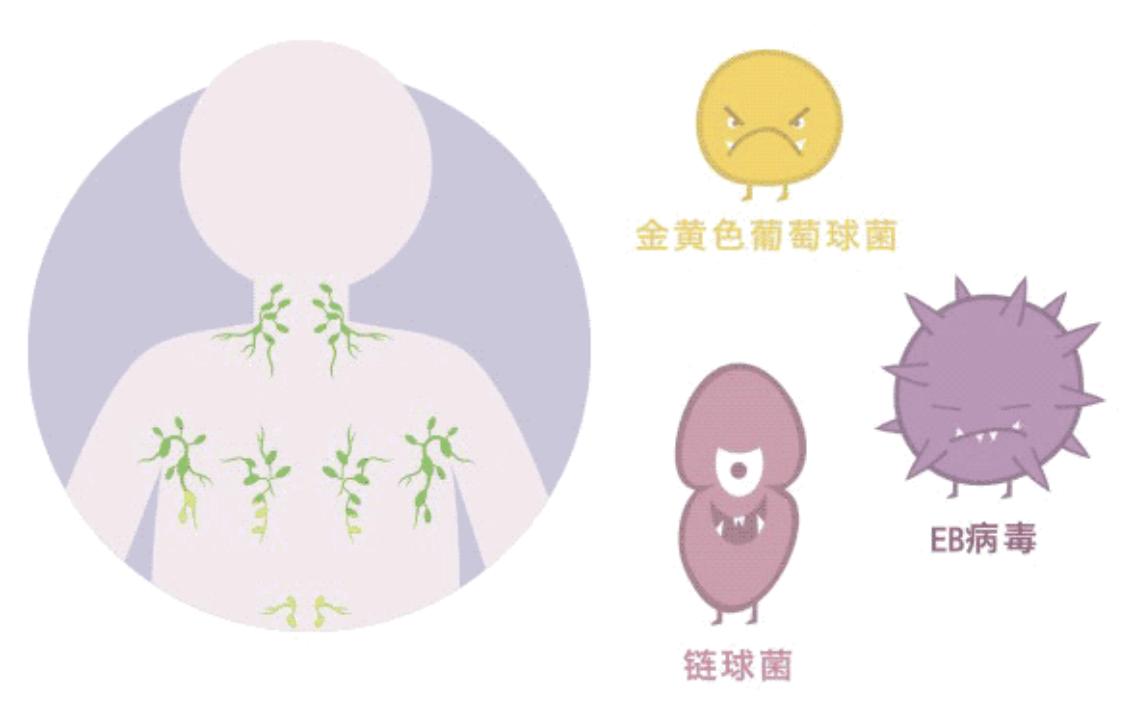 颌下淋巴结肿大预示什么,肺结核为什么引起淋巴结肿大