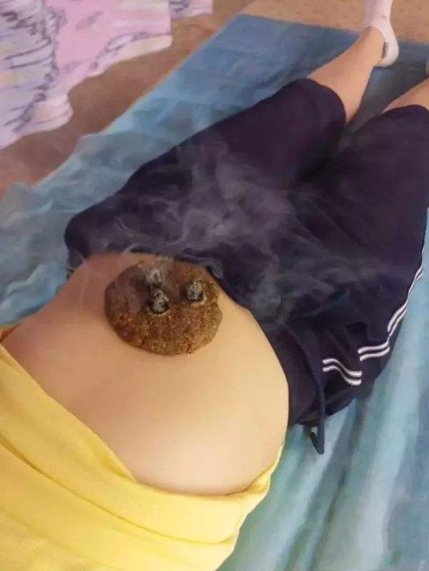 腧穴分为几大类,腧穴的分类和区别