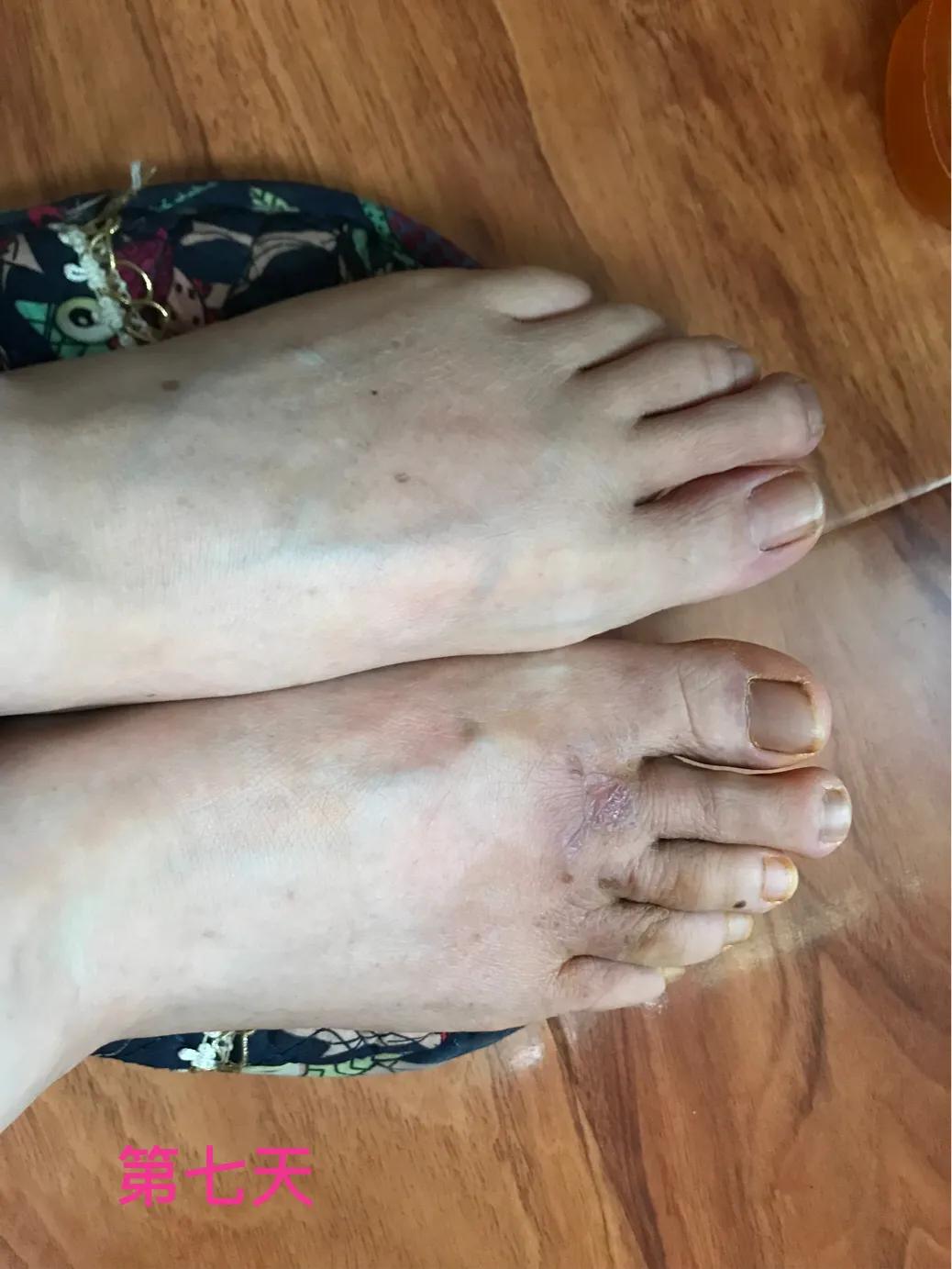 自己用中药熬的面膜靠谱吗,自己用中药做的面膜好吗