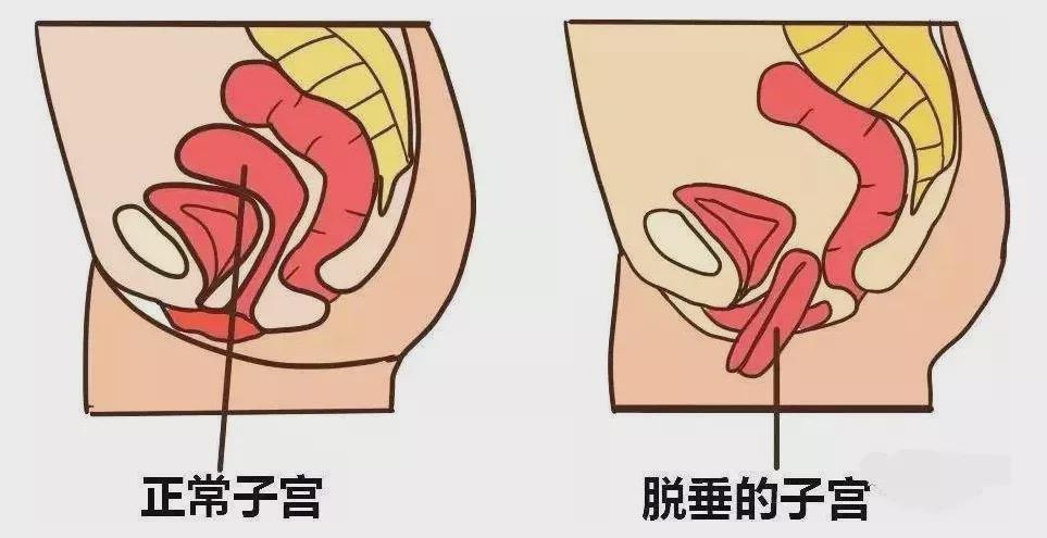 张钧甯素颜现身被*拍偷**！憔悴形象非常瘦，一双大长腿撑不满裤管