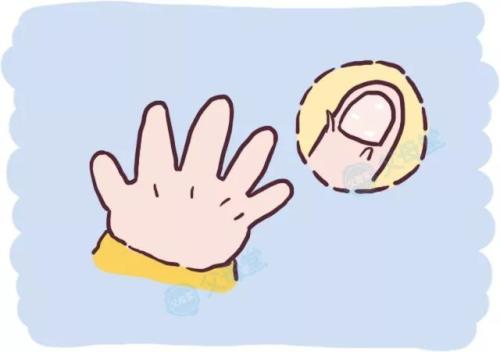 手指甲起倒刺缺维生素什么,手指甲倒刺缺维生素