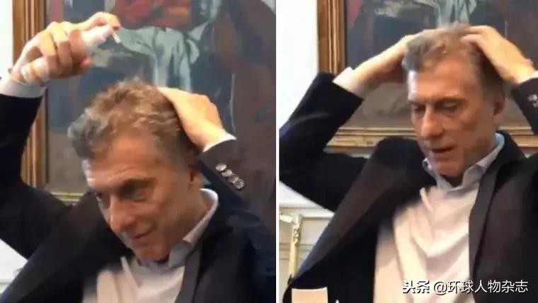 DUANG！“90后”脱发竟然惊动了这位总统，为生发水疯狂带盐！