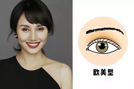 割双眼皮怎么变成内双了,割的双眼皮变成三角眼