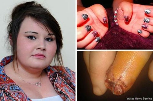 儿童化妆铅中毒,铅中毒皮肤溃烂