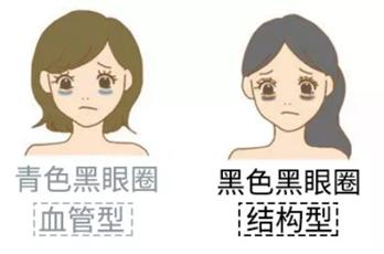 学她这样保养，50岁都不会有黑眼圈，秘密全靠这支「小黑管」