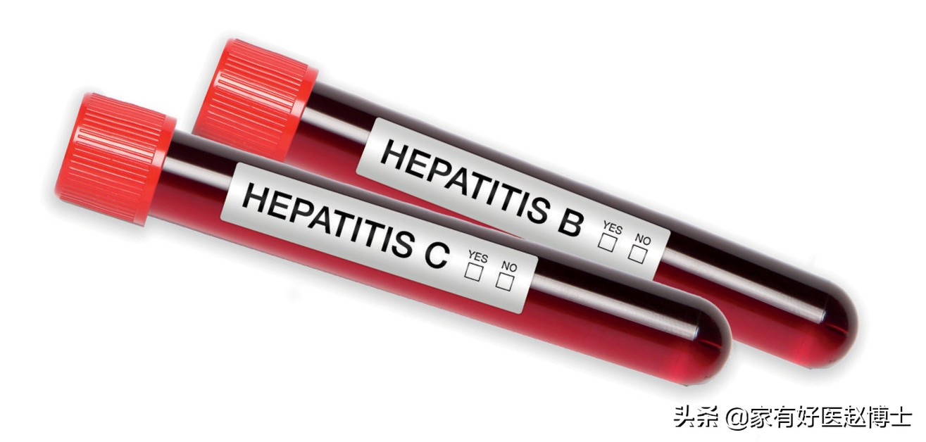 患癌最多的疾病以及预防,四种高致癌性炎症