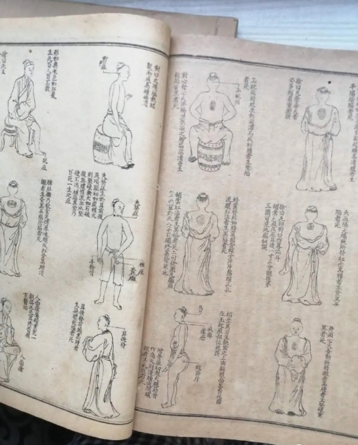 《外科正宗》:大明好先生带病编撰的一代外科医典