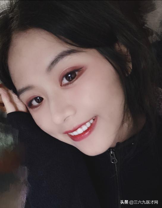 龅牙矫正成功的图片对比,2周岁龅牙可以矫正吗