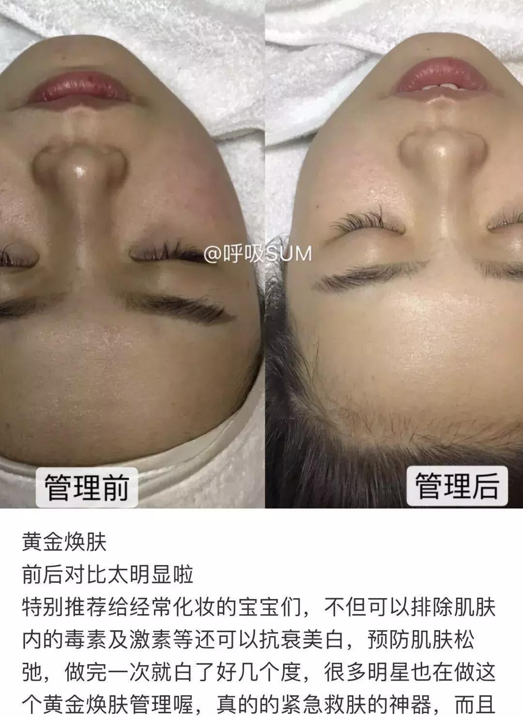 年轻人的抗老精华,用了惊艳的抗老精华