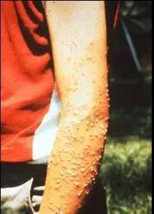 全民国家安全教育日保护公众健康,4.15全民国家安全教育日主题宣传