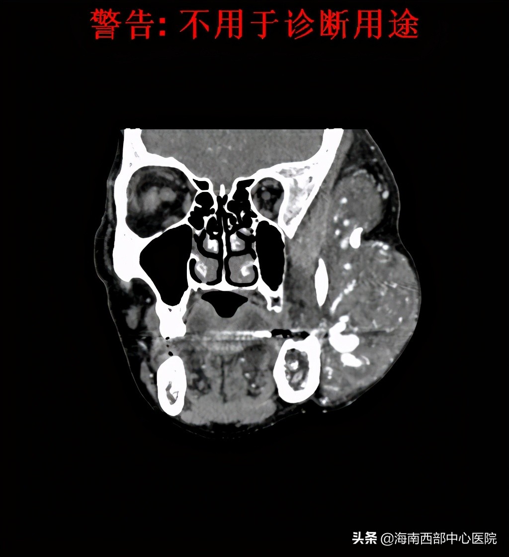 海南西部中心医院进展,海南西部中心医院三期进展