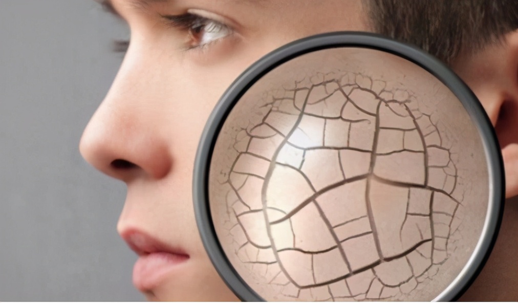 脸上皮肤干燥有皱纹，缓解冬季瘙痒的七种方法