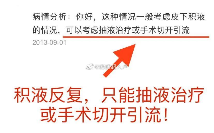 吸脂后腰部有积液抽一次,腰部吸脂一个月还有积液