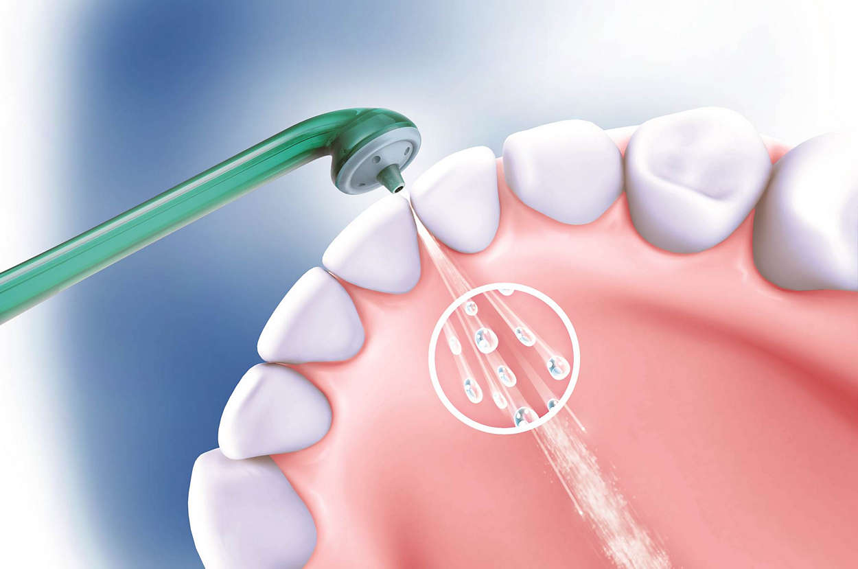 有电动牙刷还要手动刷吗,有了电动牙刷还需要水牙线吗