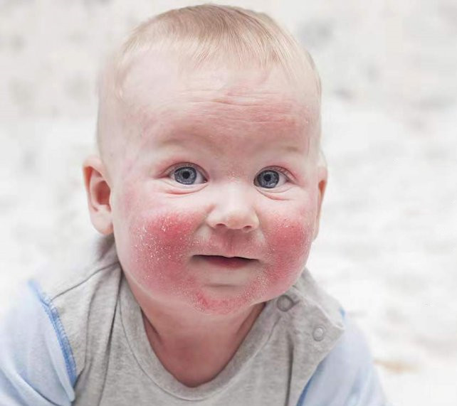 国产新品抗皱面霜,强生和启初面霜哪个好