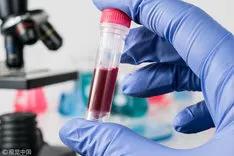 发现潜血应该检查什么,发现尿潜血