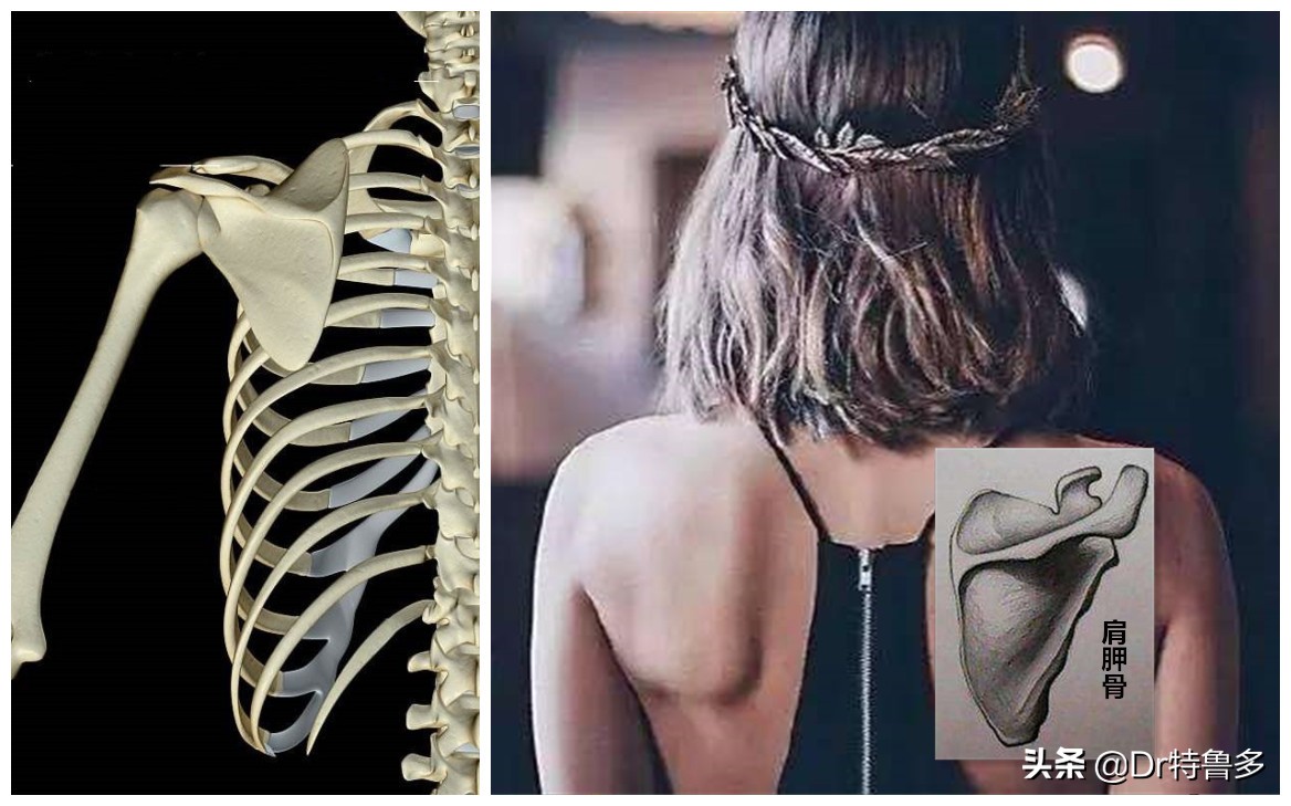 蝴蝶骨不是一种病吗,蝴蝶骨是颈椎病吗