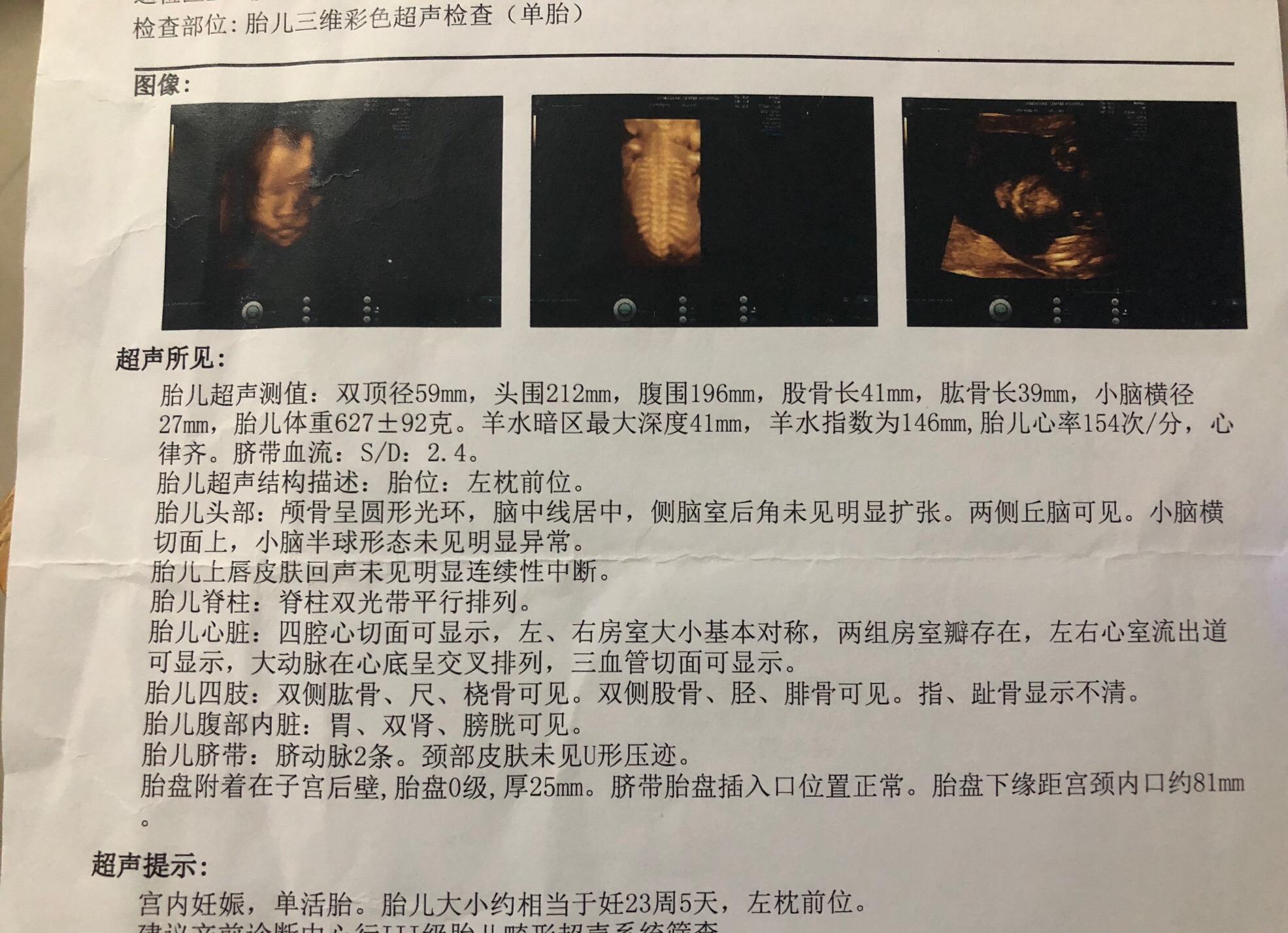 妇产科良心医生,孕妈们必看孕检全攻略