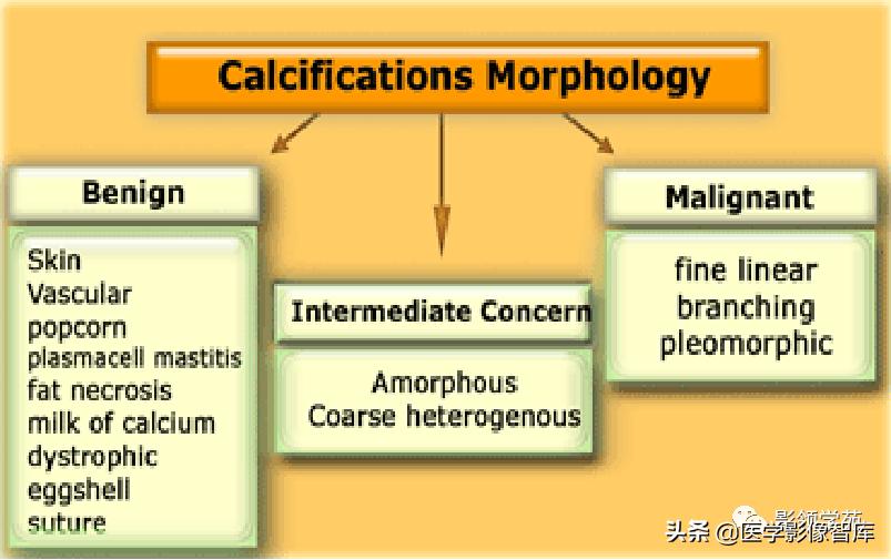 乳腺钙化怎么区分良性和恶性,乳腺钙化的诊断与分级