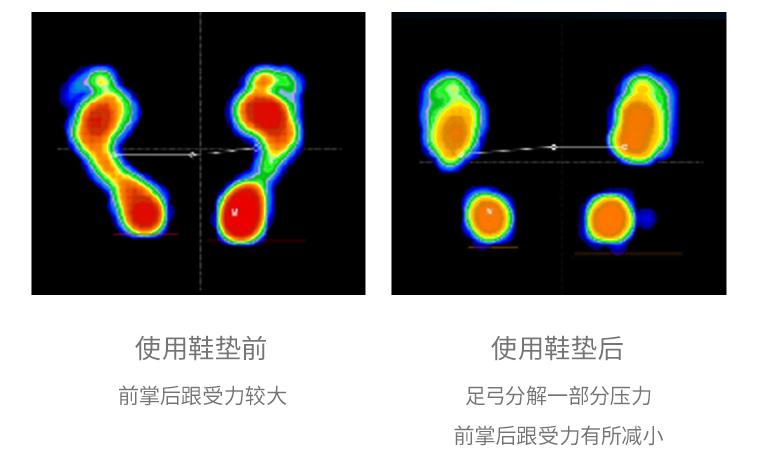 打篮球崴脚了怎么处理,打篮球崴脚脱鞋捏脚