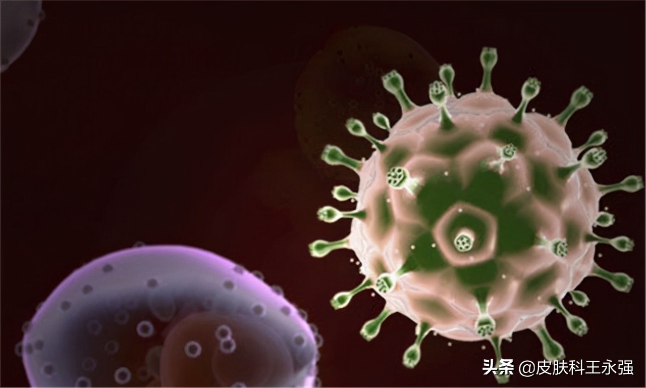 艾滋病患者，前期会有哪些表现？怎样正确的预防，医生一步步教你