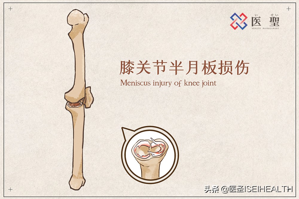 干细胞疗法再生医学,干细胞再生治疗骨折