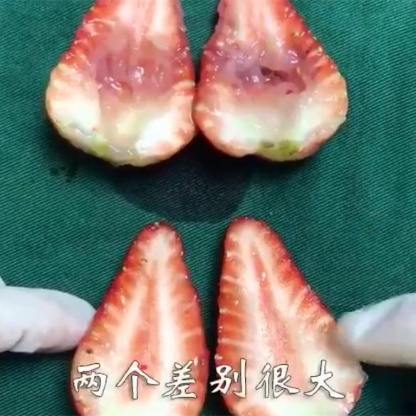 30岁人流的危害究竟有多大,人流的危害到底有多大