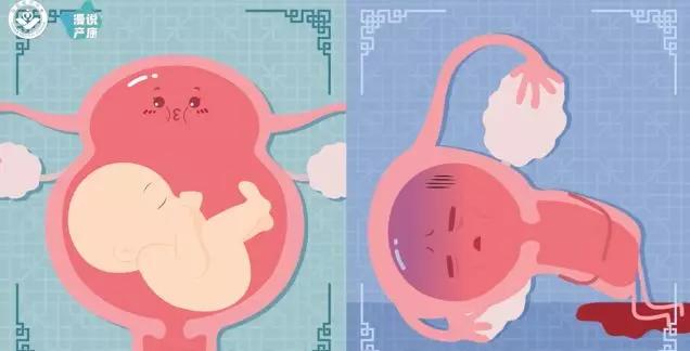 产后妈妈如何看自己月经恢复,产后怎么判断子宫恢复位置正常