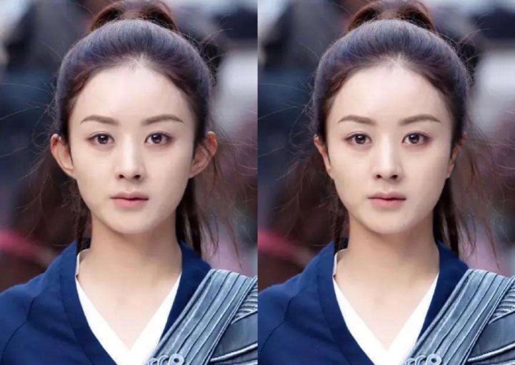 20万玻尿酸,一连打6支玻尿酸会怎么样