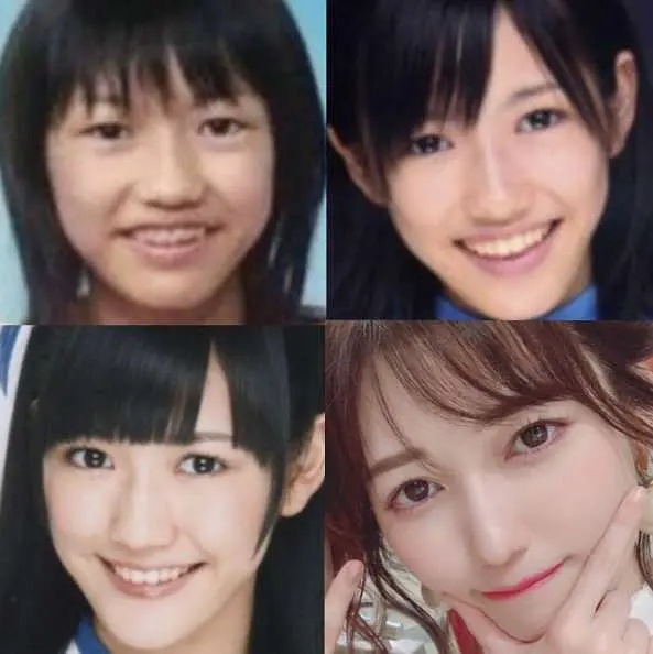 日本整容的鬼斧神工，来见识一下各位日星是整容了还是“长开”了