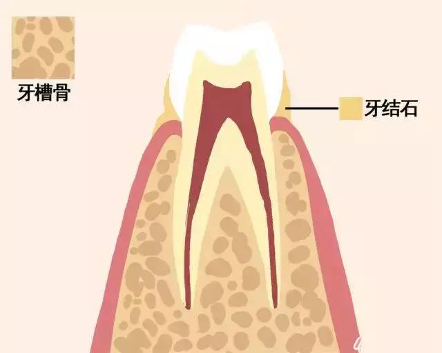 一颗牙齿的动画图片,牙齿脱落过程图解