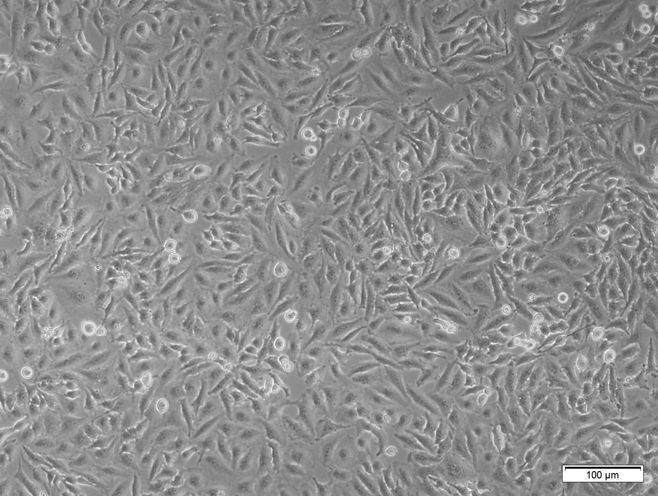 “永生”的拉克斯：身患绝症却成研究对象，被科学界无偿利用70年