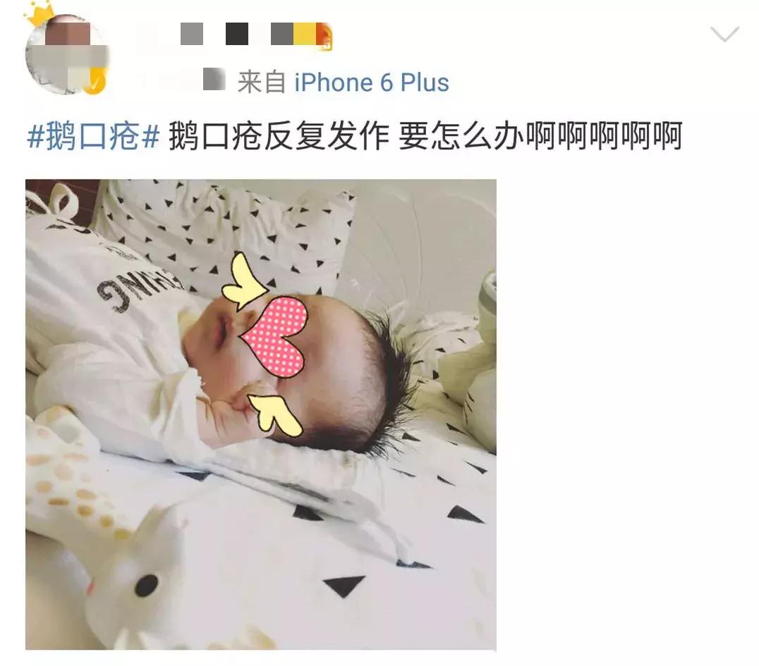 如何区分奶垢和鹅口疮,鹅口疮和奶垢要处理吗