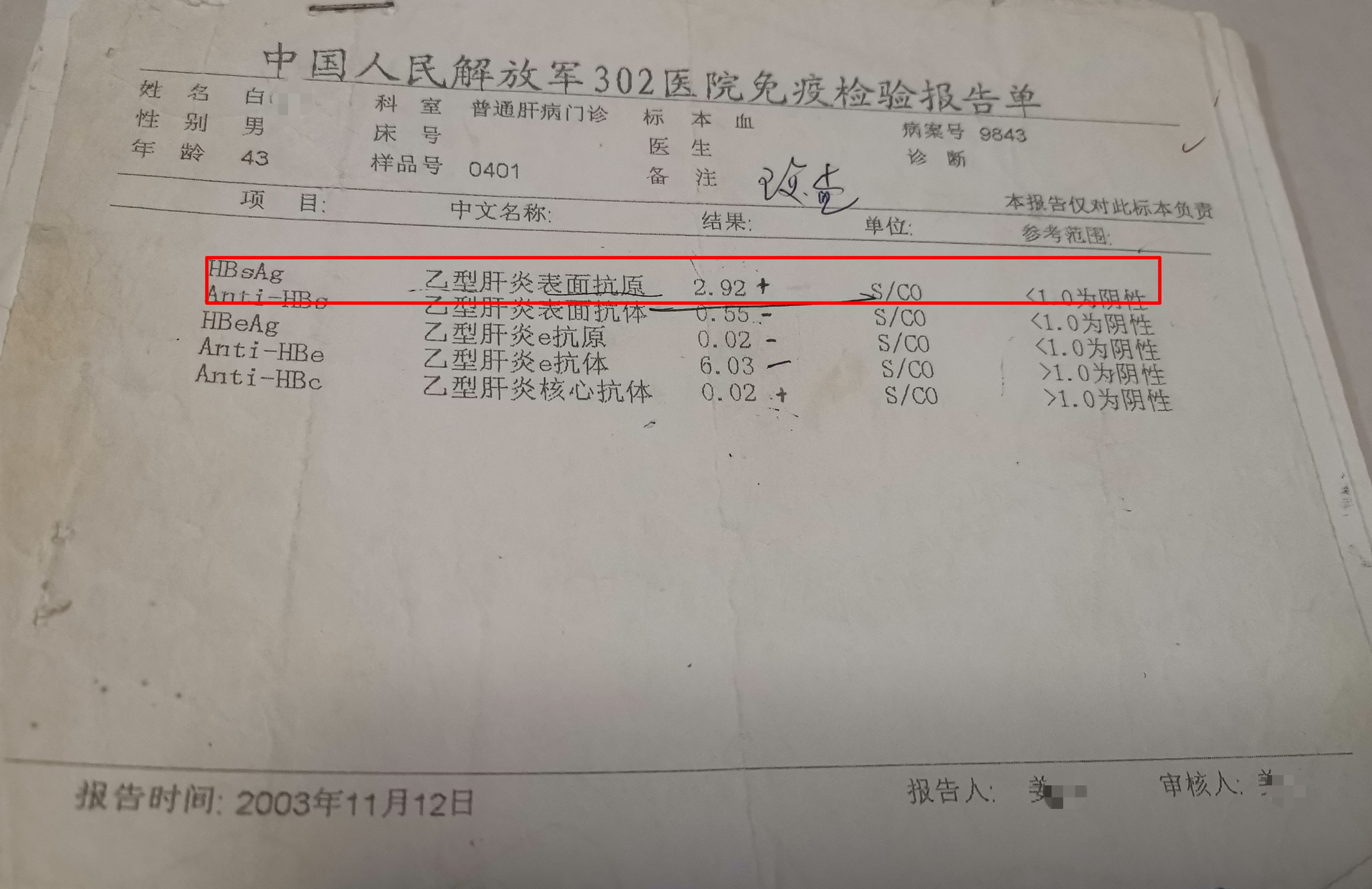 肝炎减轻肝负担,肝炎怕不怕