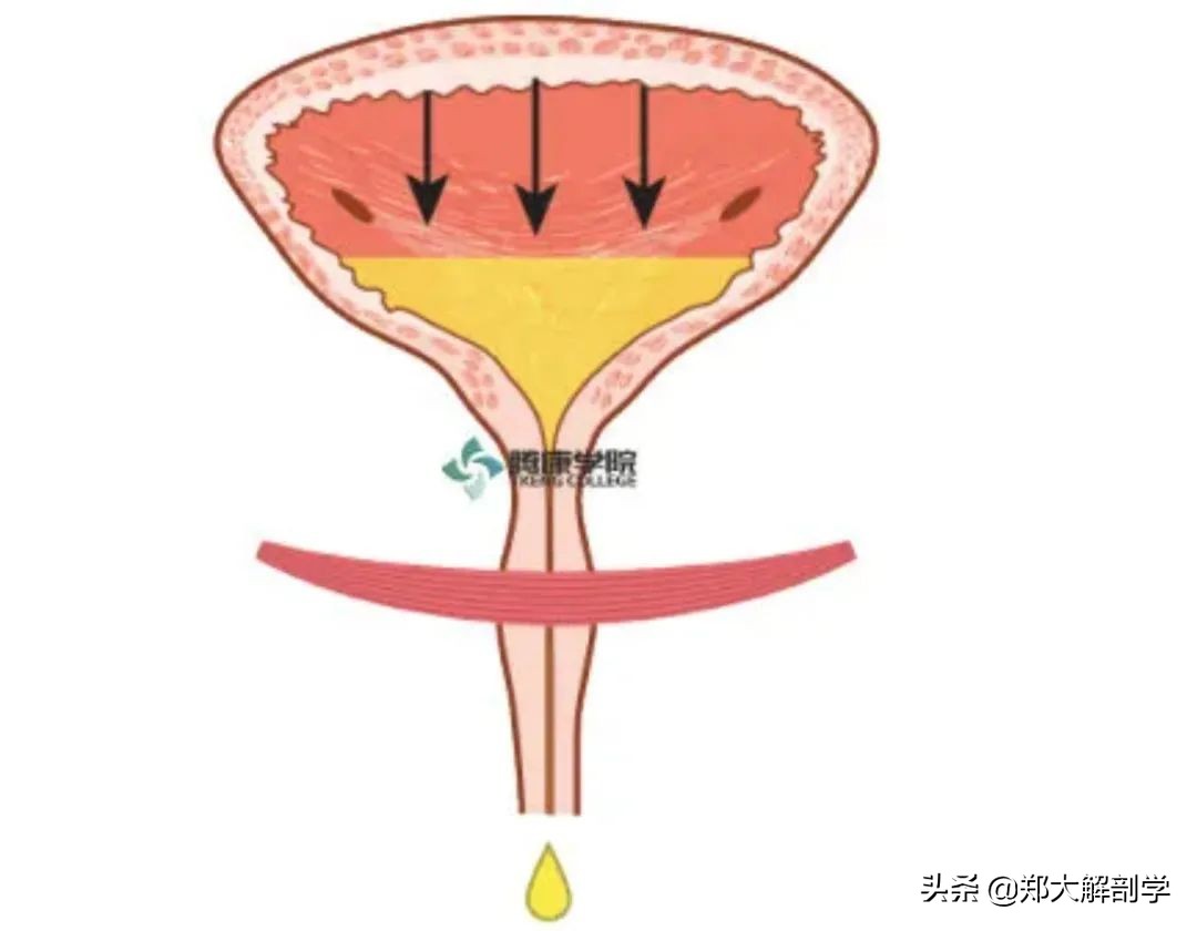 女性盆底功能障碍性疾病表现,盆底功能障碍会引起失眠吗