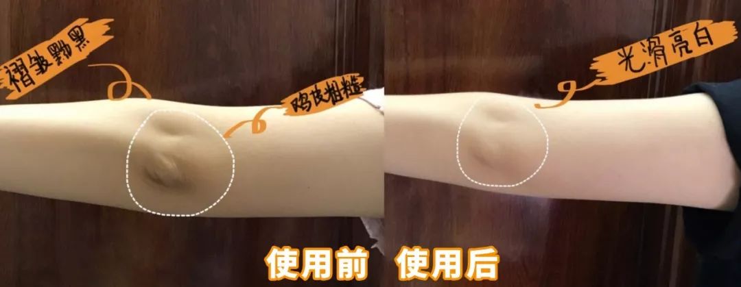 李佳琦推荐澳洲goat羊奶皂,李佳琦推荐黄黑皮克星