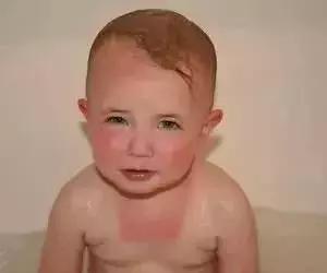 怎么选儿童专用的防晒霜,儿童防晒霜需要卸吗