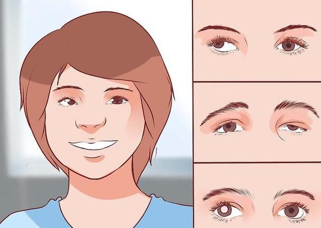 上海和平眼科医院陈培正,上海弱视治疗最好的医生