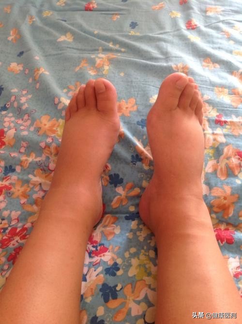 长期减肥未能有效改善,长期减肥减不下来的原因