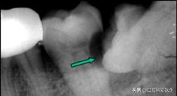 别让一张嘴毁了整张脸,别让一颗牙齿毁了一张脸