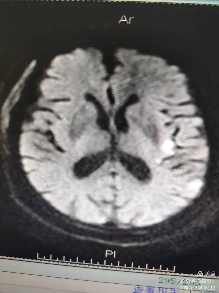 太原医院神经内科,太原市中心医院神经内科一组