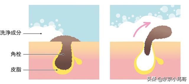 改善毛孔粗大的护肤习惯,可以改善毛孔粗大的护肤方法