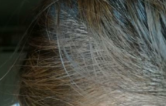 泡泡染发剂怎么更上色,泡泡染发剂浅色可以盖住深色吗