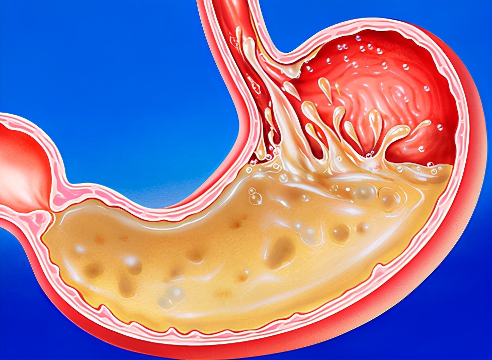 胃不好的人这五种蔬菜少吃,胃不好5种蔬菜建议平时尽量少碰