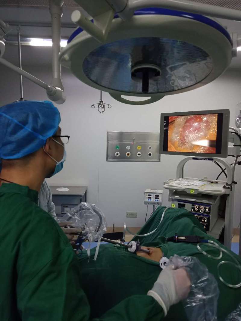 肾囊肿微创引流术,腹腔镜下肾囊肿去顶术为几类切口